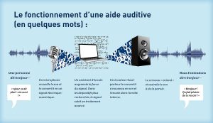 appareil auditif fonctionnement